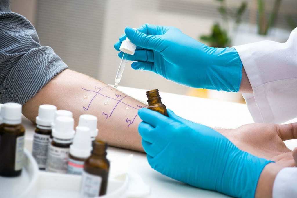 Pharmedio Alergia Test Skórny Testy alergiczne