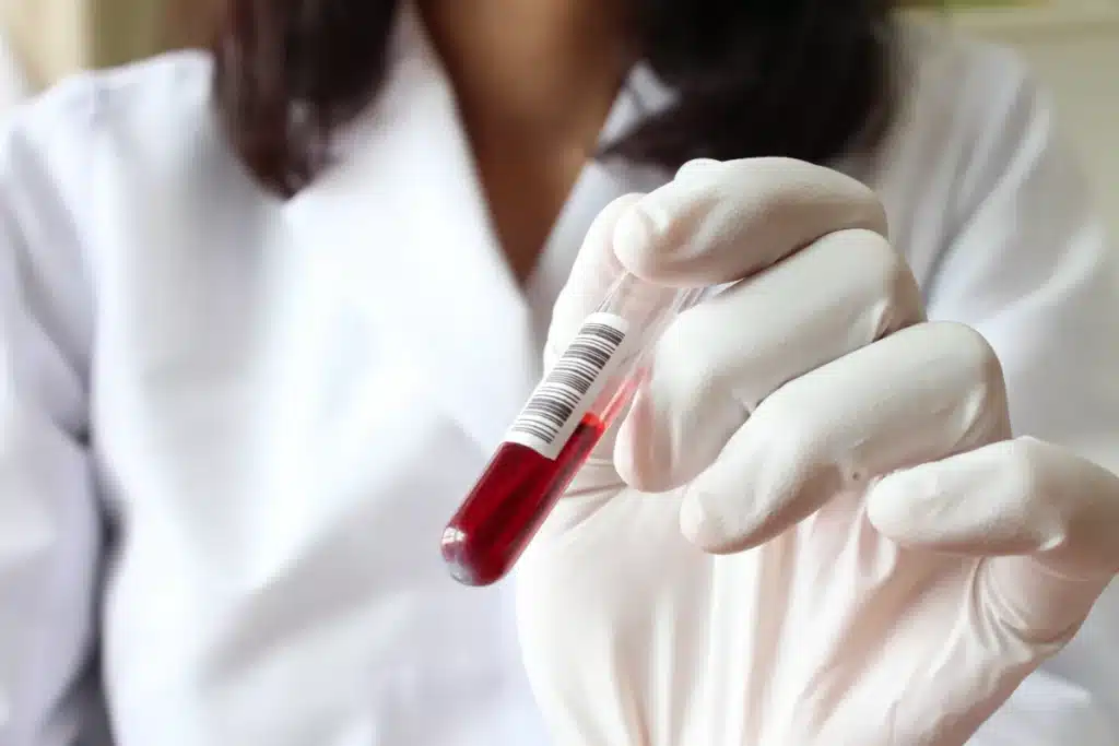 Pharmedio Badanie krwi Probówka Krew