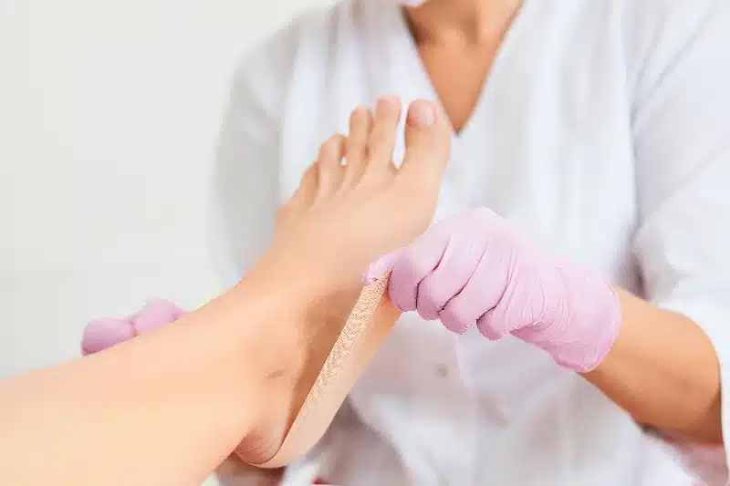 Odleżyna rana na pięcie opatrunek stopa cukrzycowa